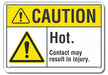 Caution Sign 7 in x 10 in Plastic